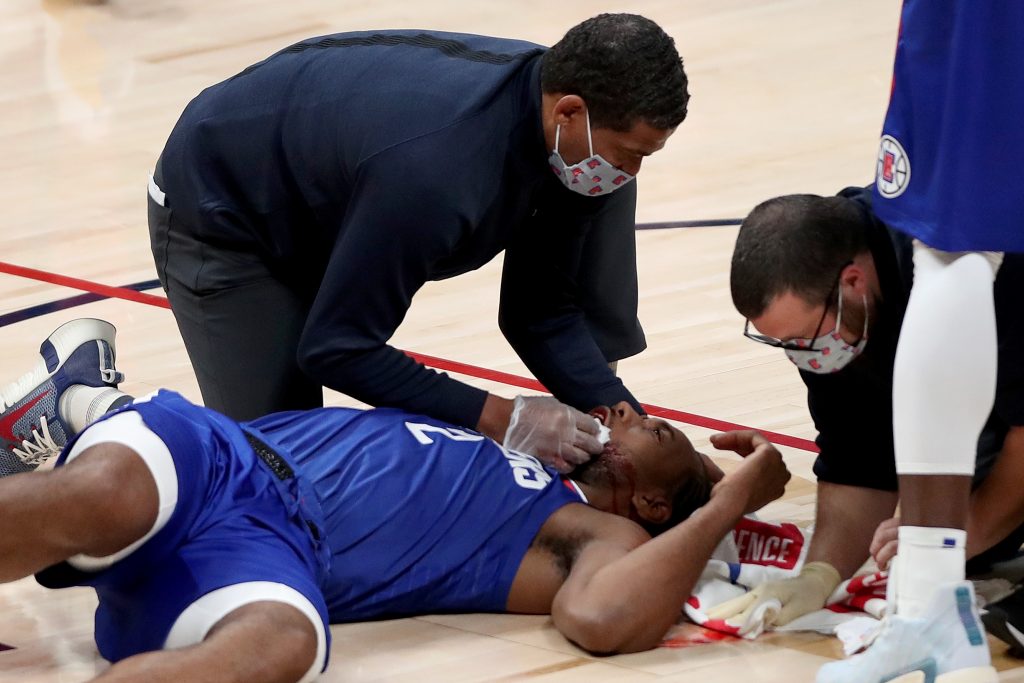 Kawhi Leonard leaves Clippers Christmas game after elbow blow to face