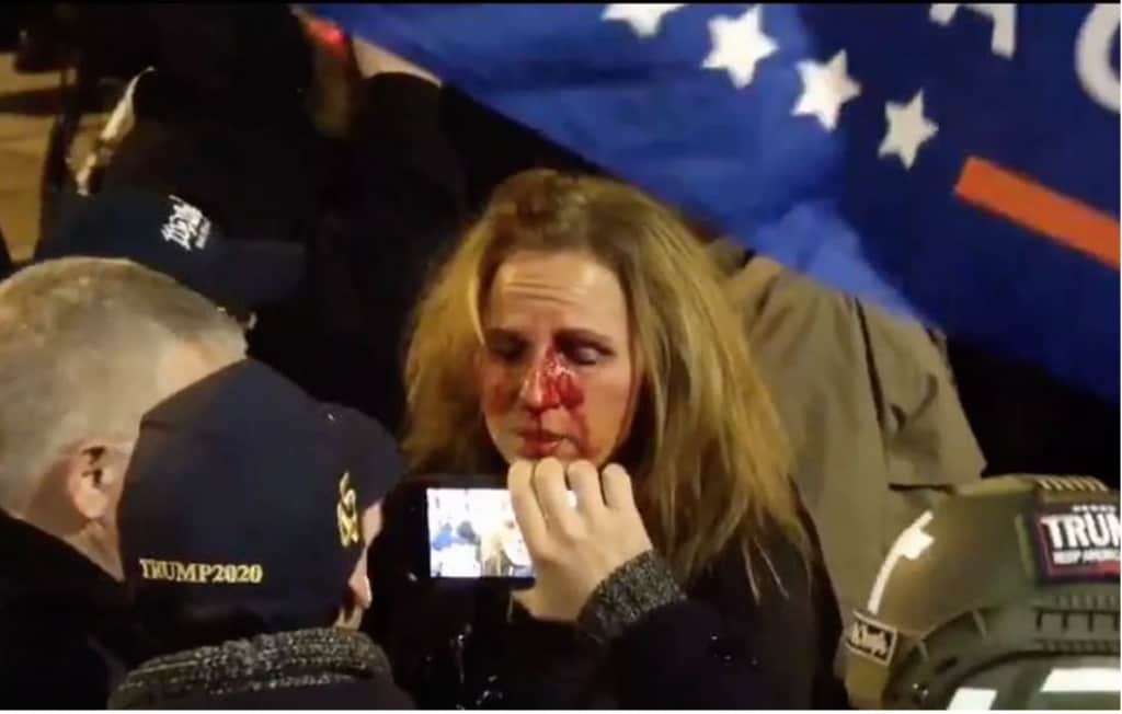 MAGA protester punched by Black woman security guard fired by UMass Hospital