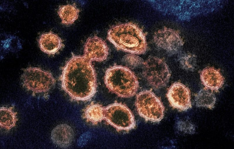 Virus variant from South Africa detected in US for 1st time