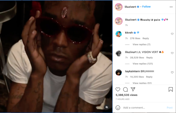 ‘And JT Talking Bout She Ain’t Embarrassed’: Fans Roast Lil Uzi Vert for Getting Supposed $24 Million Pink Diamond Implanted Into His Forehead