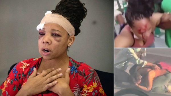 South Florida Cop Who Shot Black Woman In Face with Rubber Bullet Cleared of Wrongdoing, Police Chief Says It the Officer Was Aiming for Another Protester