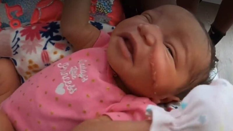 Colo. newborn requires 13 stitches on face after being cut during emergency C-section