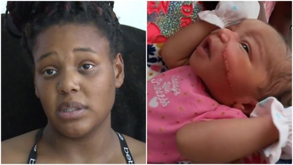 Newborn Required 13 Stitches After Her Face Was Slashed During Emergency C-Section, Family Exploring Legal Options Over ‘Heartbreaking’ Incident