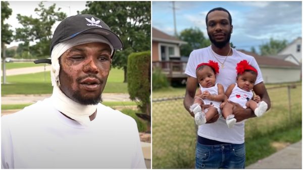 ‘It Was a Miracle’: Michigan Father Suffers Temporary Blindness, Severe Burns After Rushing Into Burning Home to Save His Twin Daughters; GoFundMe Surpasses $200K