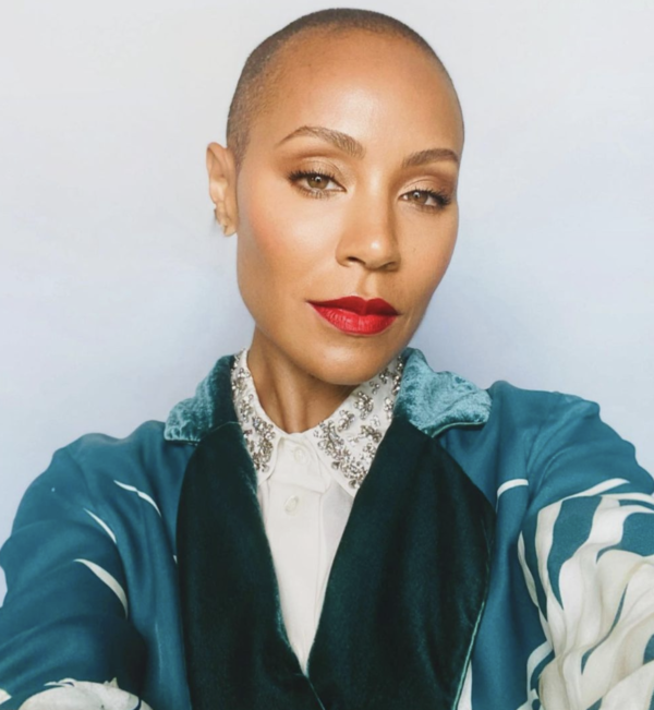 ‘It Just Showed Up Like That’: Jada Pinkett Smith Shows Effects of Alopecia