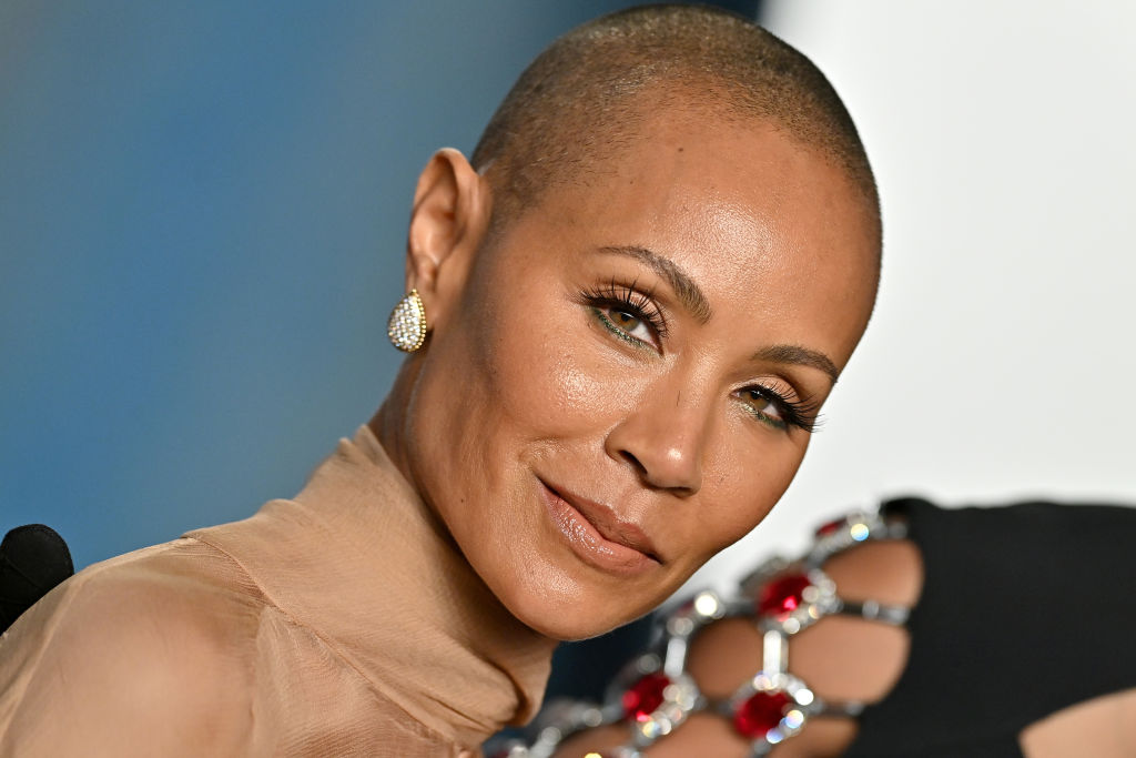 How Does Alopecia Affect Black Women?