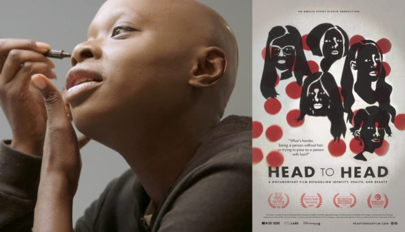 Head to Head: A new film explores how hair loss affects women
