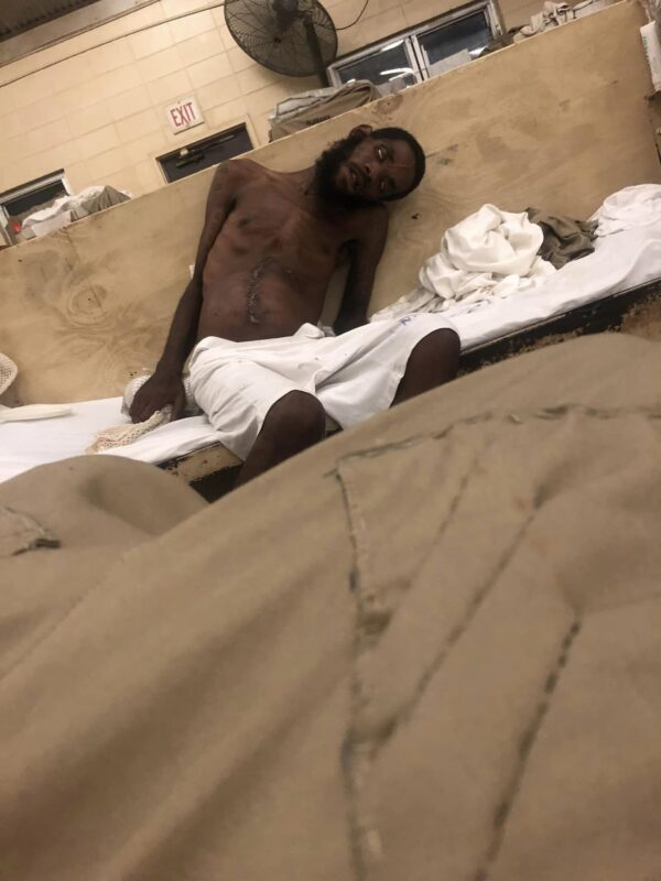 ‘Get Help’: Family Seeks Answers After Photos of Malnourished Man Raise Questions About Conditions at Alabama Prison. Sister Says He Can No Longer Walk Nor Talk; Ahmaud Arbery Family Attorney to Investigate