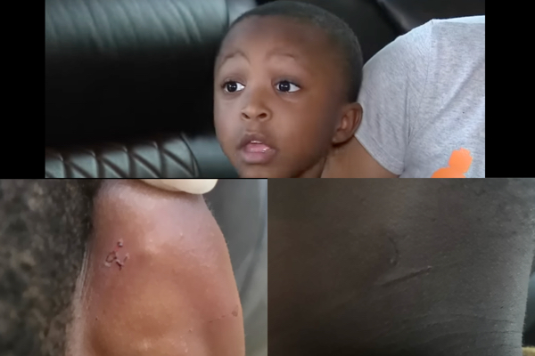 ‘That Teacher Should be Put In Jail’: Houston Mother Outraged After Terrified 5-Year-Old Says He Was Choked by Teacher’s Aide