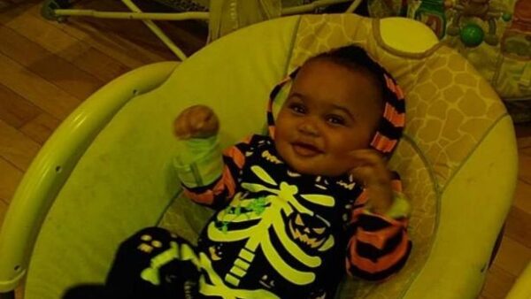 ‘His Life Has Not Even Started’: 7-Month-Old Mauled by Pit Bull Left with Fractured Skull, ‘Fighting for Life’ in Intensive Care