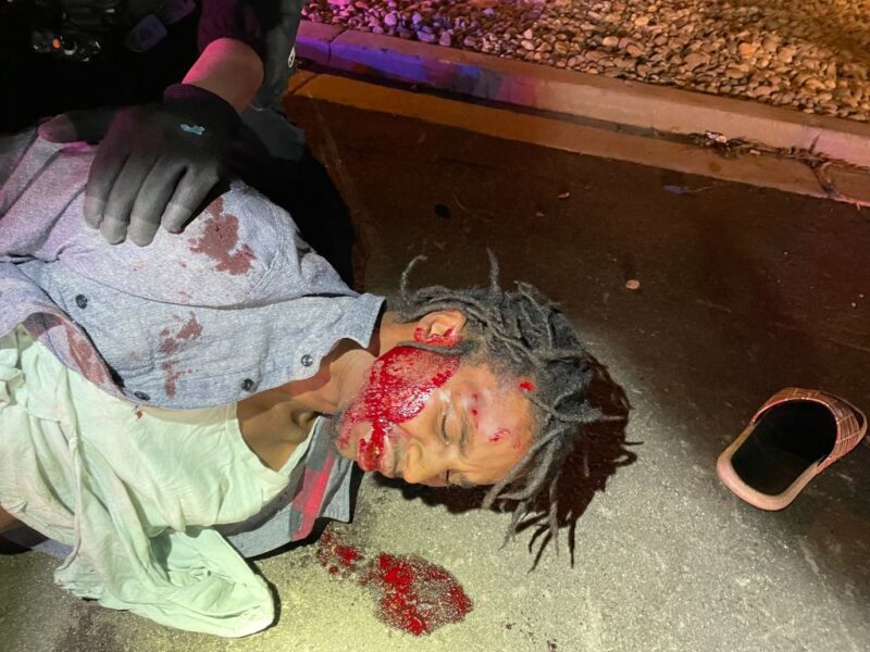 Graphic Police Brutality Photos Show Cop Smiling After Beating Black Veteran Bloody In Colorado