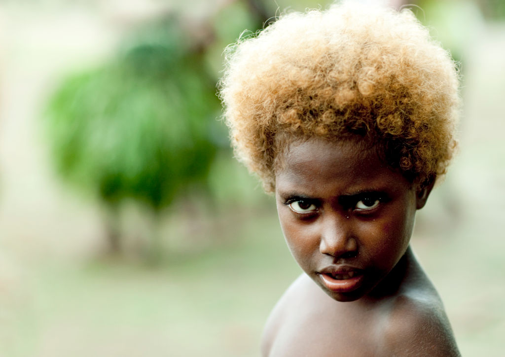 The History Of Black People With Blonde Hair