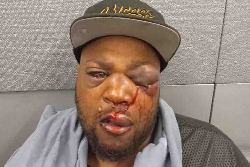 Donations Pour In For Food Cart Owner ‘Blindsided’ In Brutal Attack By Suspected White Supremacist