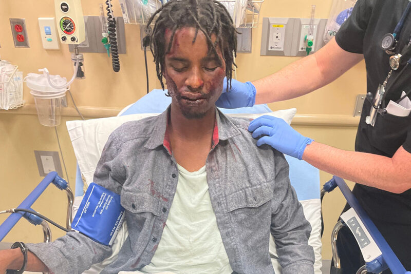 DOJ Criminally Investigating Colorado Cops Who Laughed About Brutally Beating Unhoused Black Veteran