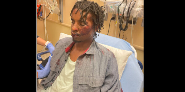 ‘Injustice’: Cops Beat Homeless Veteran, Joke About It After. DOJ Opens Criminal Investigation a Year Later, Man’s Attorney Says