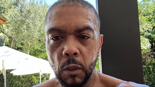 Fans Call Timbaland ‘Brave’ After He Shows Off the Results of His Hair Transplant Procedure