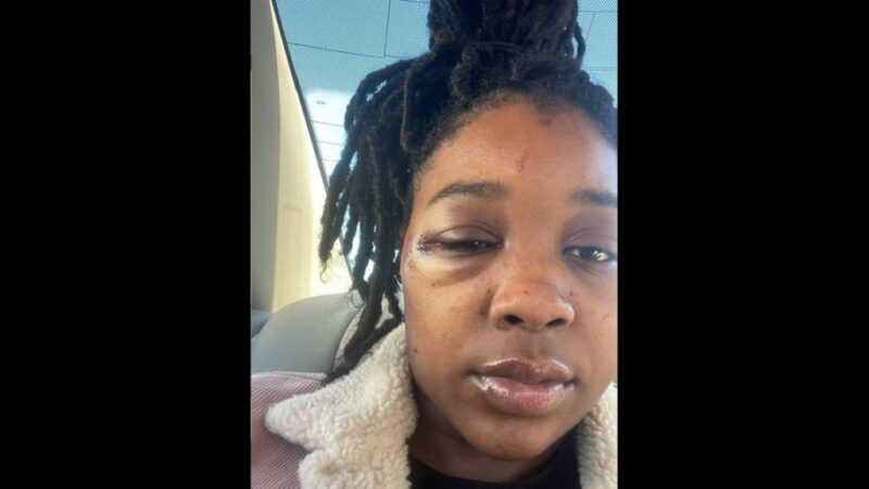 Kansas City Cops Call Handcuffed Black Woman ‘Animal’ After Brutal ‘Beating’ Caught On Video