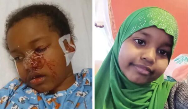 GoFundMe Created for 7-Year-Old Attacked By a Pack Dogs In Minnesota Raises Nearly $36,000