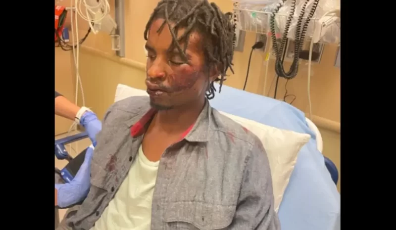 ‘You Are Not Above the Law’: Cops Beat Homeless Veteran, Joke About It After. Now, Denver Must Pay Him $1.2M, But Officers Remain on the Job