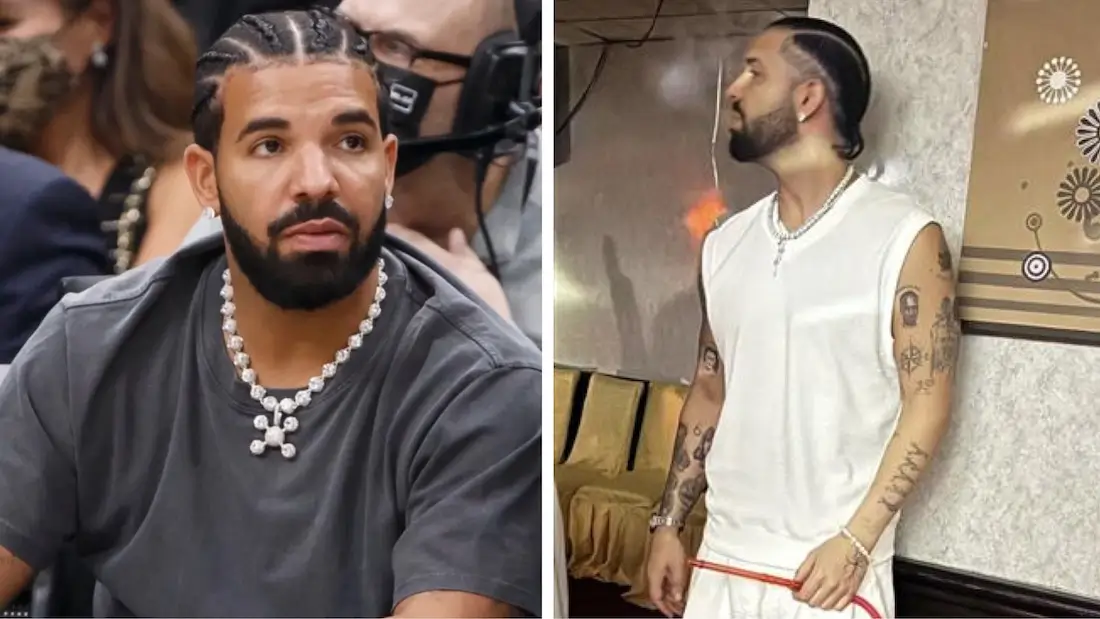 ‘Check on Drake, He Looks Sick’: Drake’s Sunken Eyes and Drastic Weight Loss Spark Health Concerns Amid Struggle with ‘Stomach Problems’