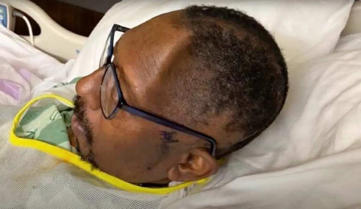 ‘Negligent Failure’: An Atlanta Hospital Lost Piece of Man’s Skull Then Charged Him $19K for a Replacement That Later Led to an Infection, Lawsuit Says