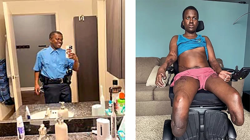 ‘Incomprehensible’: Black Man Forced to Fight Other Recruits In Denver Police Academy Loses Both Legs After ‘Brutal Hazing Ritual;’ Files Lawsuit to Expose Cover-Up