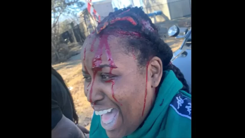 ‘My Whole Brain Is Bleeding, Mama!’: Black Woman Whose Scalp Was Torn Off By Relentless K-9 Settles with California Police for Nearly $1M