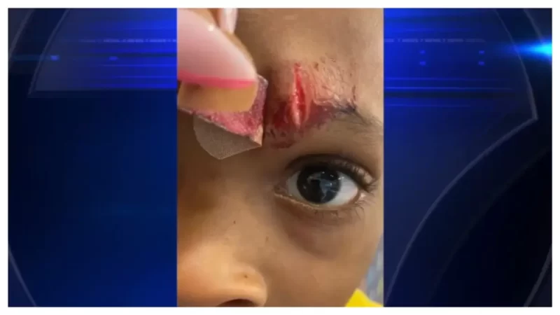 ‘It Could’ve Been His Eye’: Florida School Tells Mom 5-Year-Old Son Hurt Himself with Pencil, Leaving Him with Bloody Gash, But Mother Claims Teacher Inflicted Cut with a Ruler