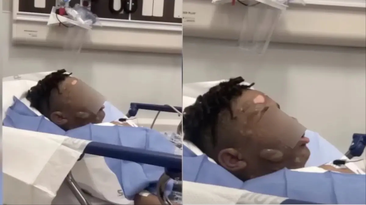 ‘I Was Seeing Red’: Georgia Mother Furious After Son’s Friends Allegedly Pour Scalding Water on Him During Sleepover Prank, Leaving Him Disfigured