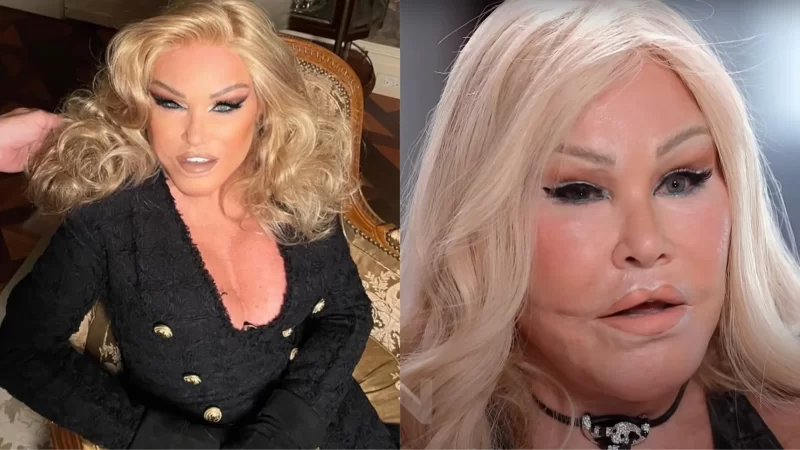 Cause of Death Revealed for Billionaire ‘Catwoman’ Jocelyn Wildenstein, Who Survived on $900 Social Security After Blowing Through Fortune