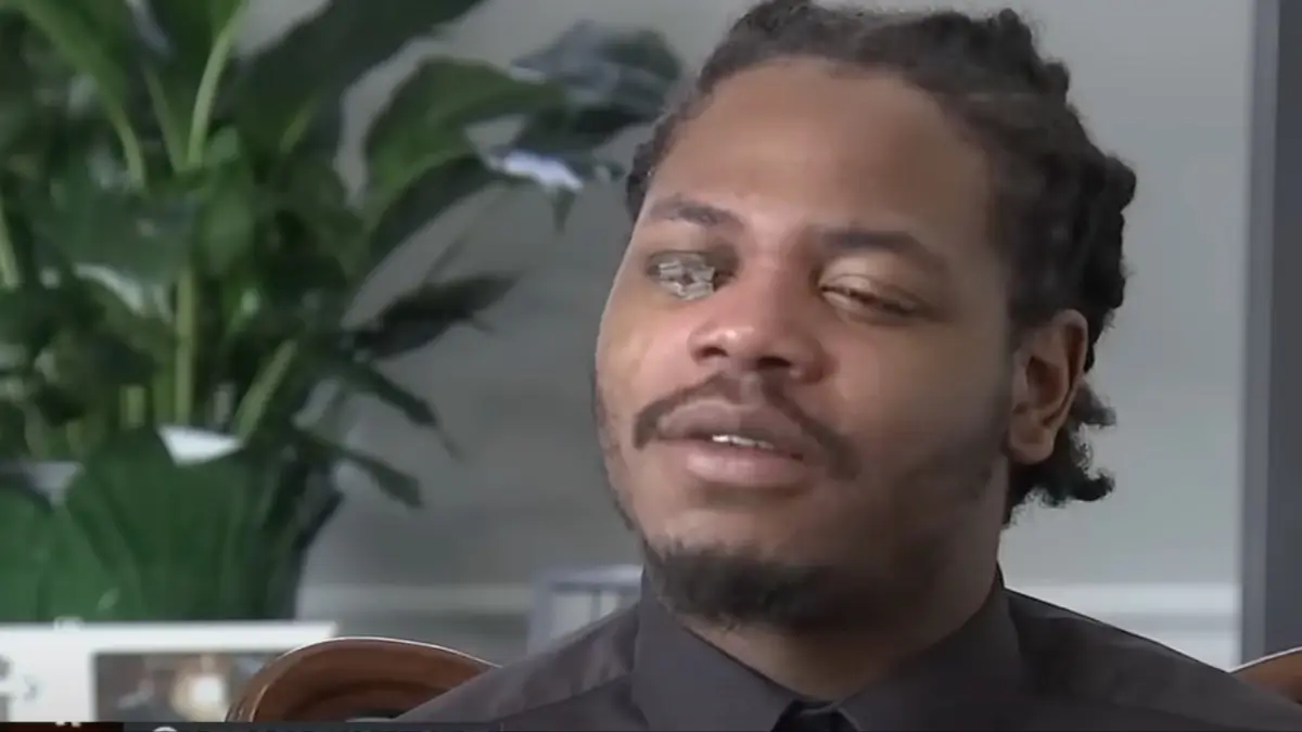 ‘He Followed His Command’: Chicago Man Who Suffered Permanent Eye Damage After Cop Uses Taser on His Face Says He Was Trying to Protect Female Friend