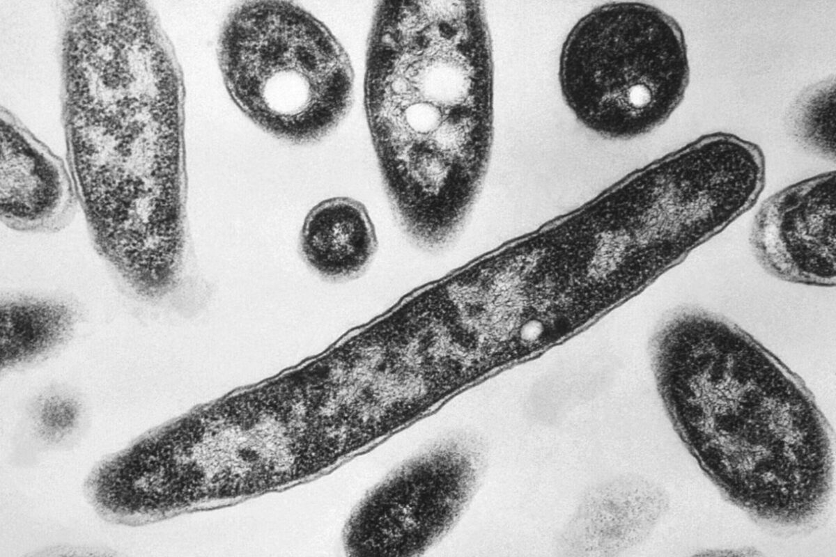 What to know about Legionnaires’ disease, which has sickened dozens in New York City