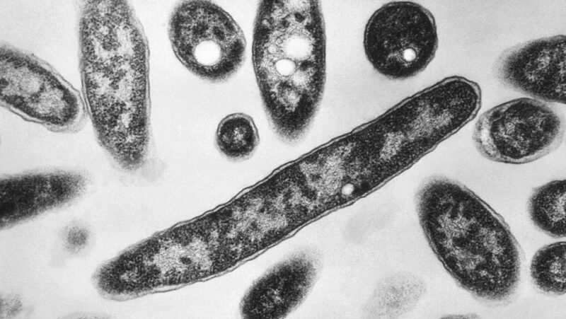 What to know about Legionnaires’ disease, which has sickened dozens in New York City