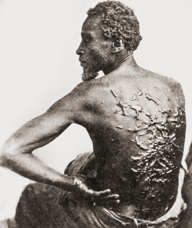 Trump Admin Purges National Parks Of Slavery Exhibits Including Iconic ‘The Scourged Back’ Photo