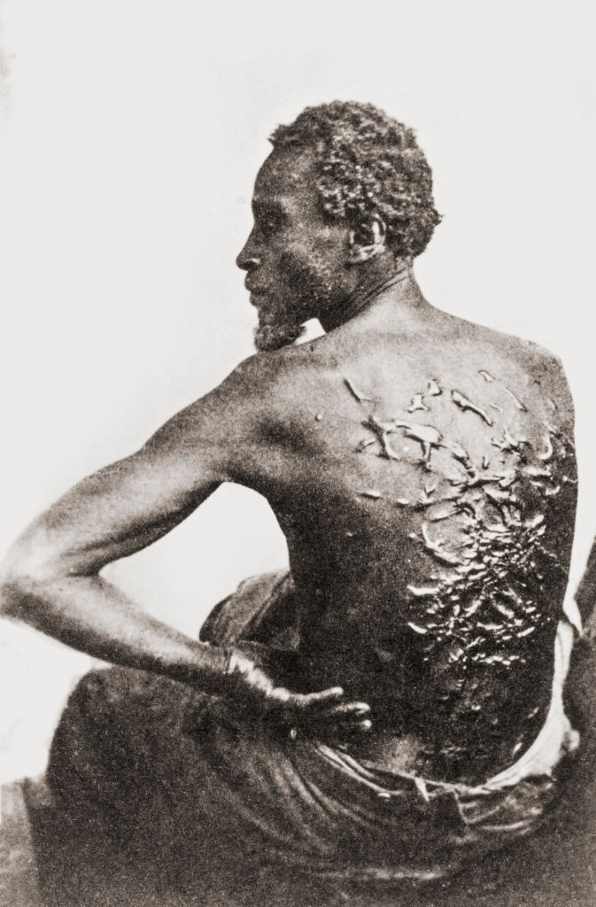 Trump Admin Purges National Parks Of Slavery Exhibits Including Iconic ‘The Scourged Back’ Photo
