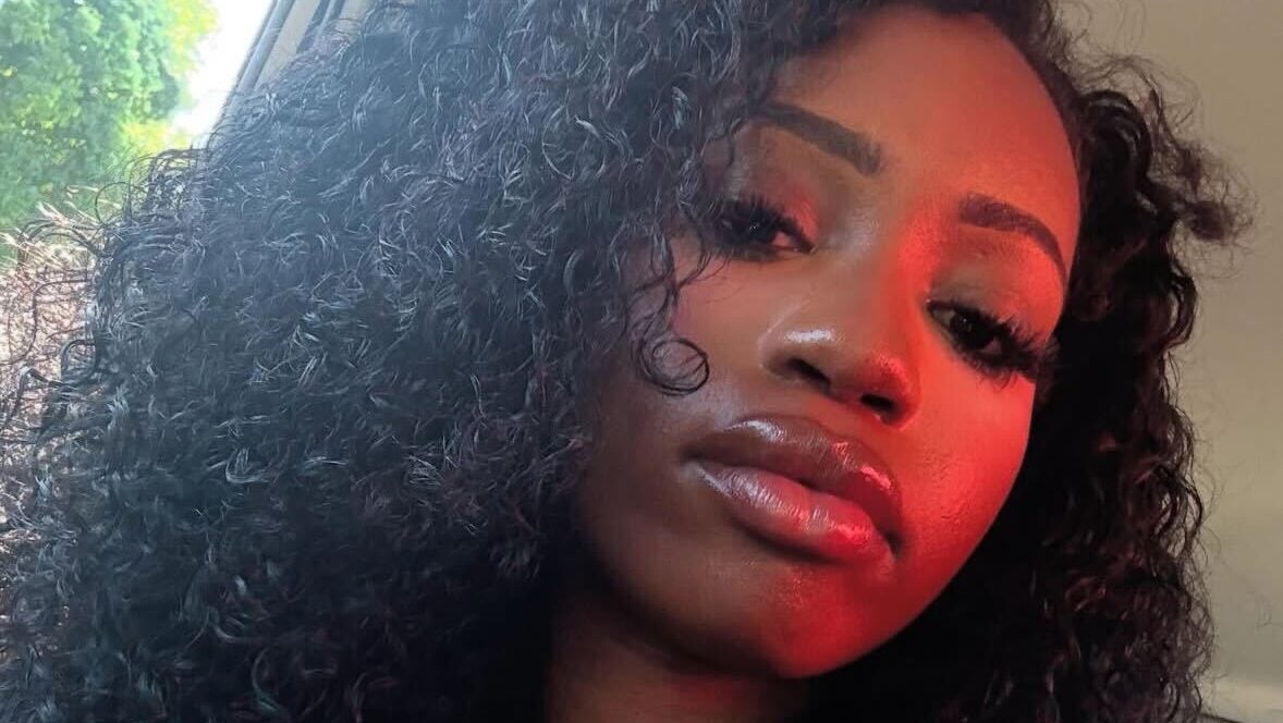 College student who contracted meningitis speaks out and urges awareness after having legs, fingers amputated