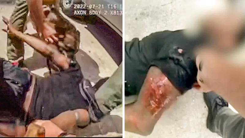 ‘Think We Have the Wrong Guy’: Innocent Black Florida Man Attacked by Cops and Mauled by K9 After ‘Matching the Description,’ Files Lawsuit