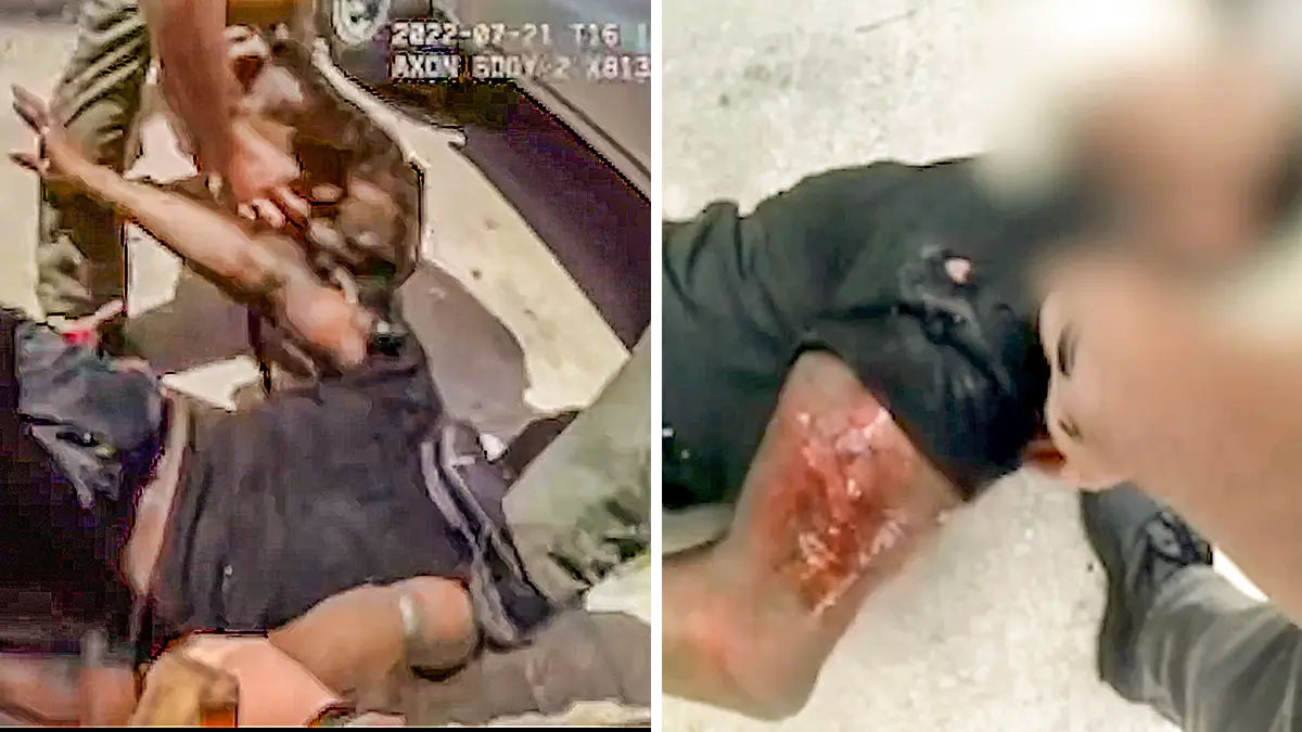 ‘Think We Have the Wrong Guy’: Innocent Black Florida Man Attacked by Cops and Mauled by K9 After ‘Matching the Description,’ Files Lawsuit