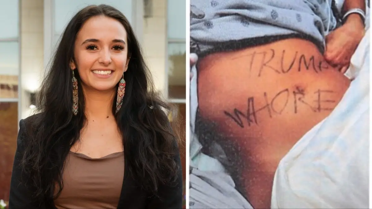 ‘That’s Deranged’: Ex-GOP Aide Claimed She Was Disfigured in Anti-Trump Attack By Three Men, But Investigators Found Out It Was All a Twisted Tale