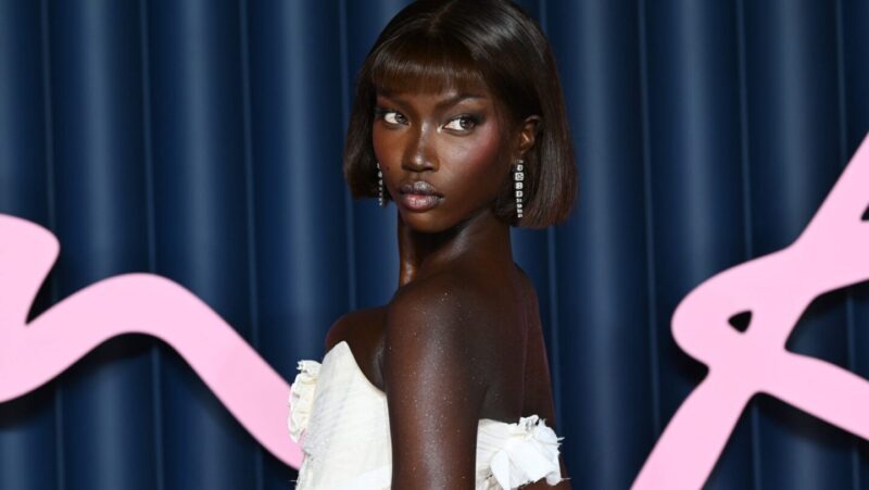 Anok Yai reveals she underwent surgery after being diagnosed with congenital defect