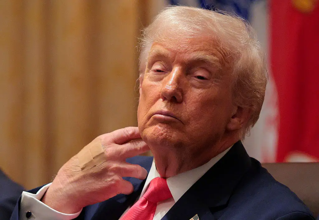 ‘Seriously Rotting Away’: Social Media Zooms In on Trump’s Bandaged Hand After Viral Sleeping Episodes, Convinced They’ve Solved His Health Mystery