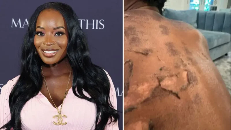 ‘Chileee Somebody Lying’: Atlanta Doctor Blasts Shamea Morton’s Lawusit Over Damaging Chemical Peel. Fans Claims the Details Don’t Add Up