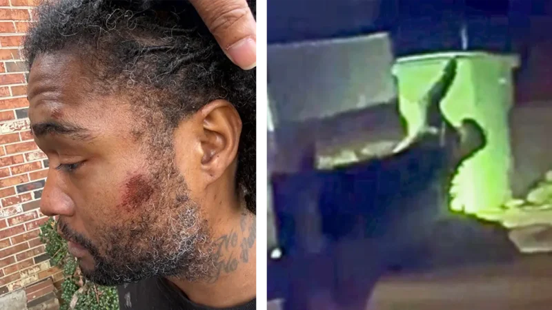 ‘You’re Going to Kill Me!’: Black Man Pleads for His Life As Alabama Cop Strikes Him with Flashlight, Bashes His Head Into Pavement, But That Wasn’t Enough, Video Shows