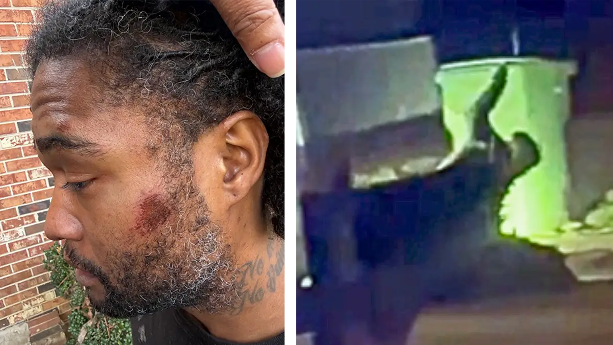 ‘You’re Going to Kill Me!’: Black Man Pleads for His Life As Alabama Cop Strikes Him with Flashlight, Bashes His Head Into Pavement, But That Wasn’t Enough, Video Shows