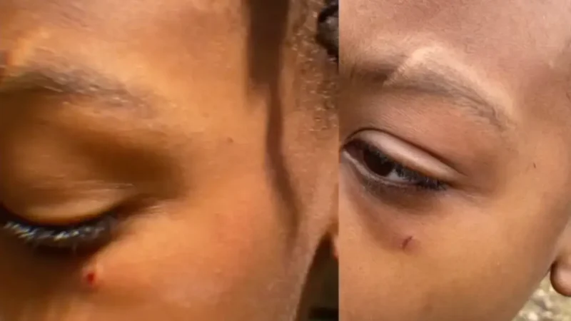 ‘Why Is She Not In Jail?’: 9-Year-Old Boy Says Substitute Teacher Told Classmates to Attack Him, Leaving Him with Black Eye and Concussion