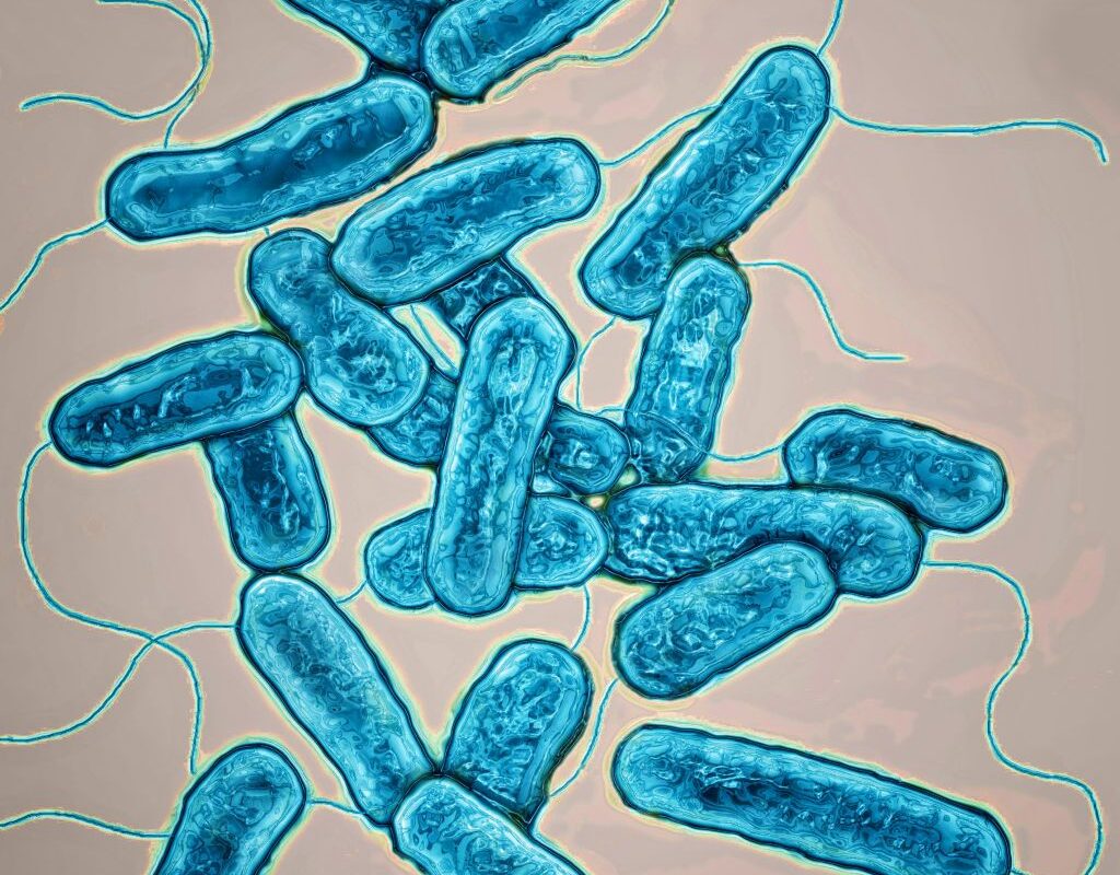 In New York City: 10 Things To Know About The Ongoing Outbreak