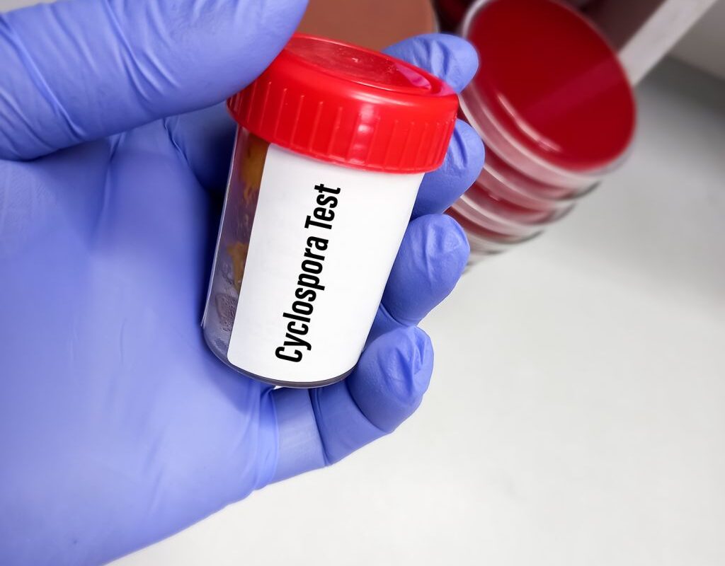 Everything You Need To Know About The Cyclospora Outbreak