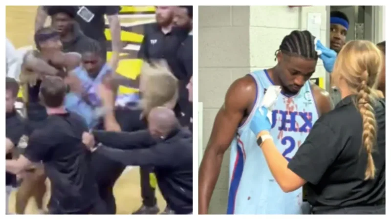Woman Left with ‘Gnarly’ Broken Nose In Bloody Brawl at TBT Basketball Tournament