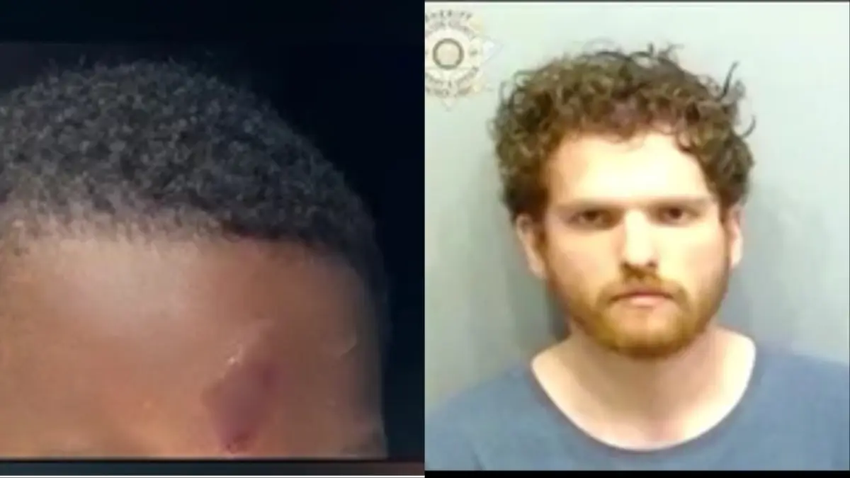 ‘Poor Little Baby’: Black Parents Say White Therapist Violently Shoved Their Autistic Son into a Shelf, Then the Center Allegedly Tried to Hide It