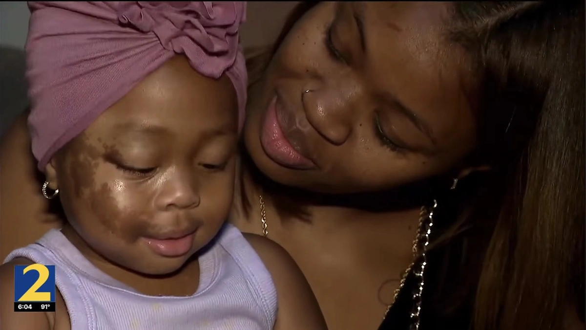 ‘My Baby’s Toes Were Dangling!’: 2-Year-Old Black Toddler Rushed to Hospital After Fire Extinguisher Crushes Her Foot at Georgia Daycare